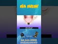 3D CẮM IMPLANT Nha Khoa Quốc Tế Athena 