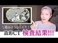 【検査結果】半年ぶりのCT、癌はどうなっていたか?…そして1月後半、また救急搬送された今の状態。