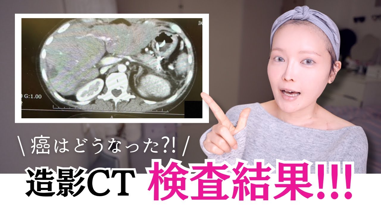 【検査結果】半年ぶりのCT、癌はどうなっていたか？…そして1月後半、また救急搬送された今の状態。