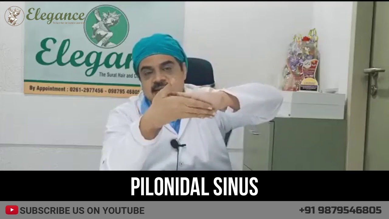 Recurrent Pilonidal Sinus Corrective Z Plasty By Dr Ashutosh Shah Plastic Surgeon Surat Gujarat