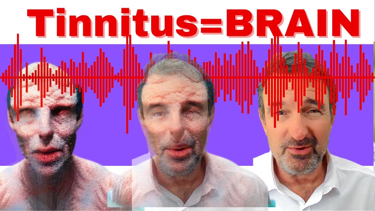 Does Tinnitus Affect The Brain An In Depth Analysis YouTube Does Tinnitus Affect The Brain An In Depth Analysis Youtube