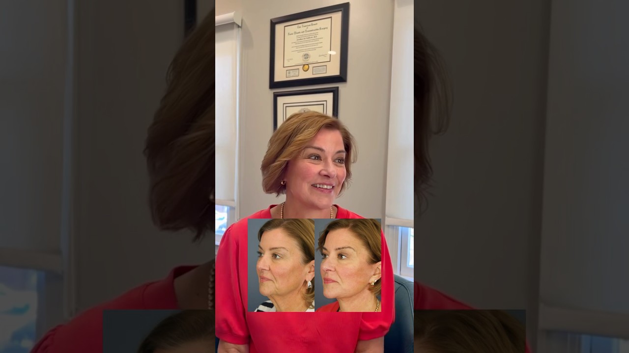 Lowe Face & Neck Lift Results Revealed