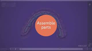 Details PartialCAD 3 3 Chemnitz   Split denture feature Guide