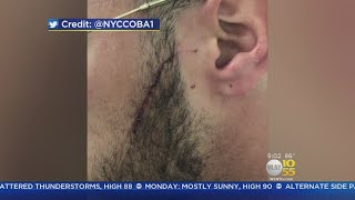 Rikers Correction Officer Slashed