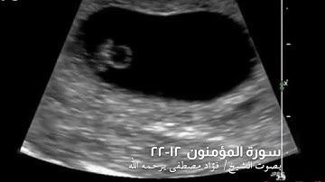 ما تيسر من سورة المؤمنون || بصوت المُقرئ الشيخ/ فؤاد مصطفى كمال الحسن - رحمه الله