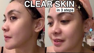 SIMPLE 3 STEP ROUTINE FOR CLEAR SKIN | PARA KANG NG REJUV | ft YesStyle | Shey Panopio