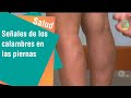 Los calambres en las piernas pueden ser una señal de algo más grave | Salud