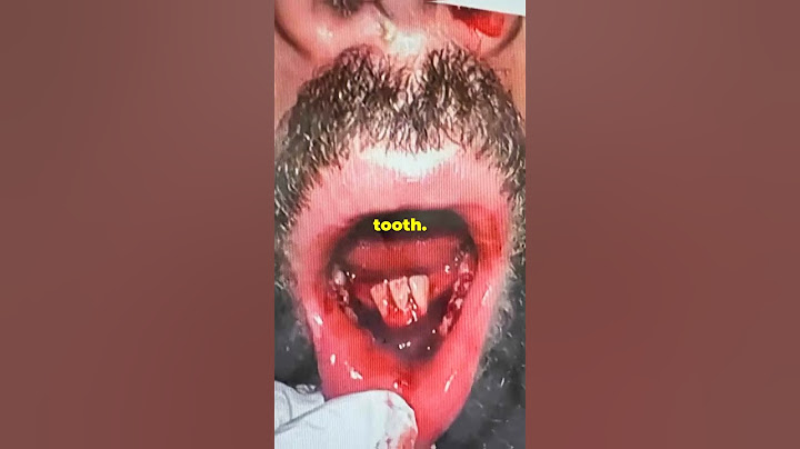 How Chimaev Destroyed Whittaker's Jaw (and his UFC career)