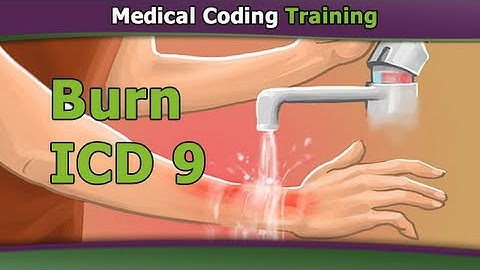ICD-9 Burn Codes — ICD 9 Code for Third Degree Burn