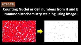 Counting Nuclei or Cell numbers from H and E Immunohistochemistry staining using ImageJ