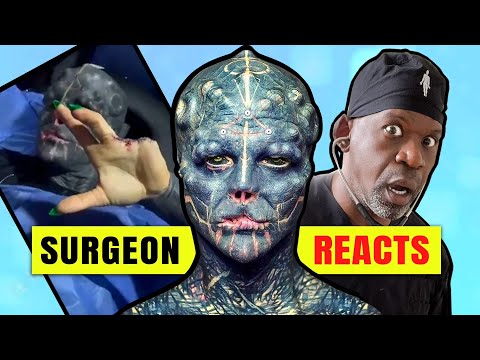 Surgeon Reacts to