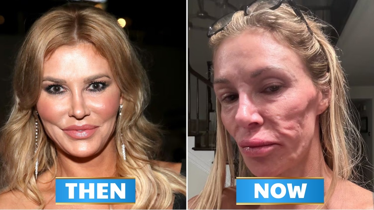 15 косметических процедур участниц реалити-шоу «Настоящие домохозяйки», которые закончились кошма...