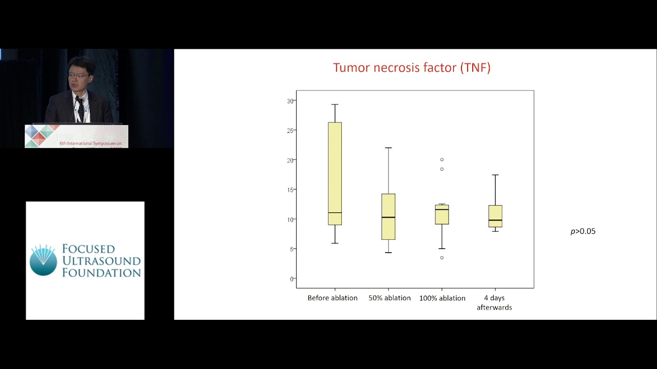 Brian Lang - HIFU treatment on thyroid and immune functions for benign thyroid nodules (2018)
