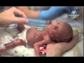 La lucha de un bebé prematuro por sobrevivir conmueve al mundo
