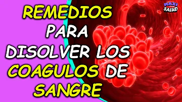 ¿Qué se puede tomar para disolver un coágulo de sangre?