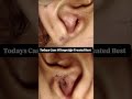 #skintoskincontact#medicine#cosmeticdermatology#skincondition#brightskin#skindisease#youtubeshorts