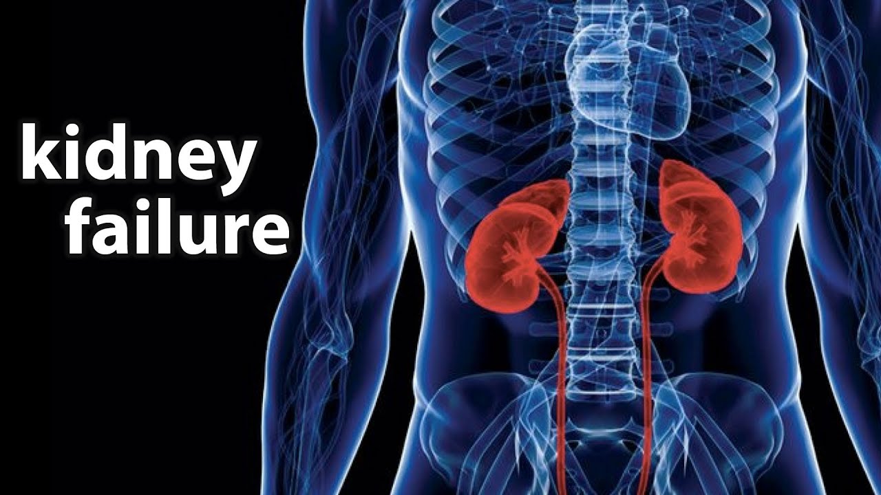 What Happens When Your Kidneys Fail