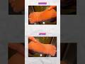 இனிமே பாத வெடுப்பு இல்லாமல் Easya நடக்கலாம் Cracked Heels Remedy! #shorts #footcrack