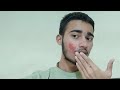 Ye Mere Face Pe Aaj Kya Ho Gaya 😰