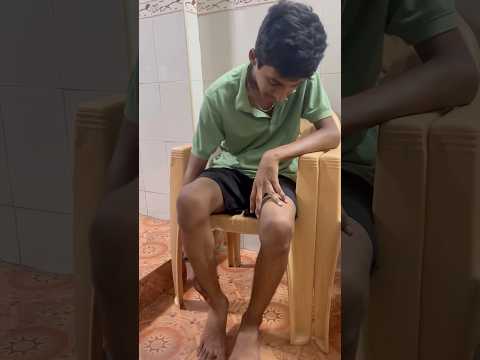 😭😭Kaal la sama adi #minivlog #tamilshorts #funnyshorts #viralshorts