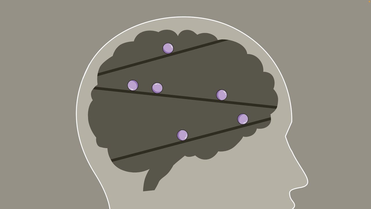 ASMR ㅣ Бесконечные покалывания