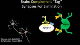 Deciphering neurodegeneration: Inflammation, immune response, and Alzheimer's