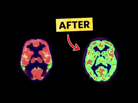 ▶ ADHDVision · How To Trigger ADHD Hyperfocus Instantly