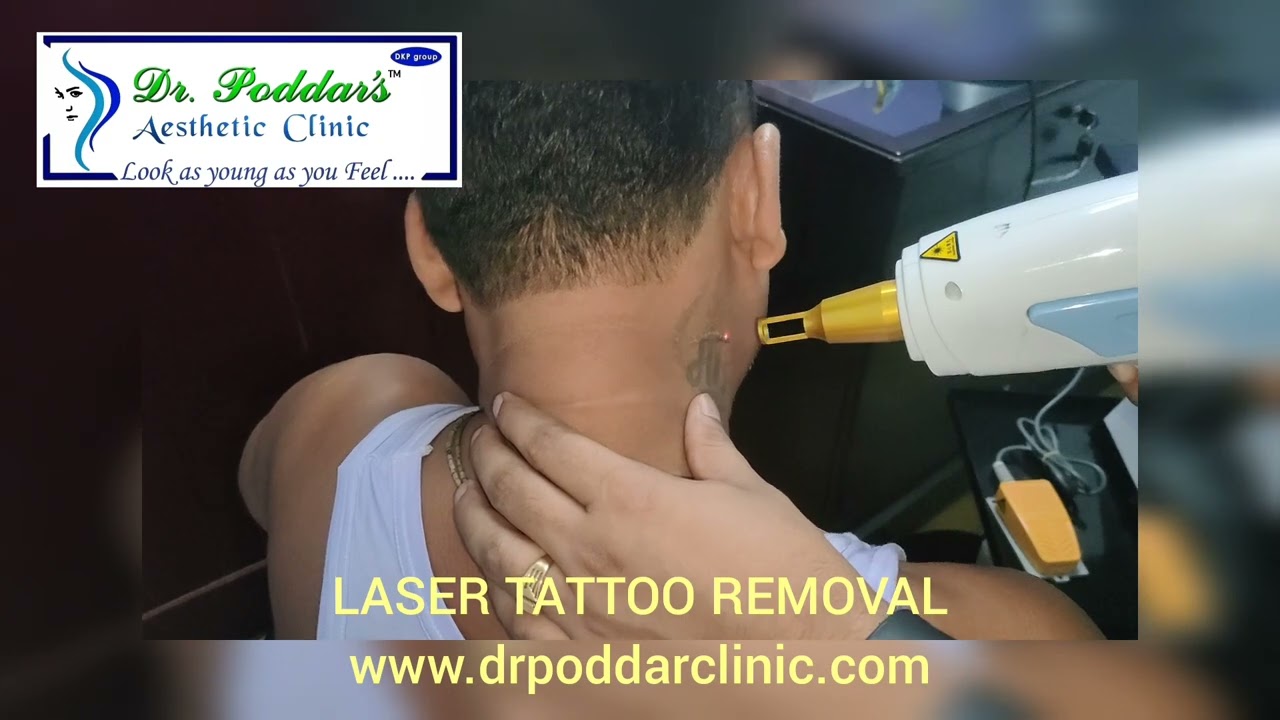 Laser Hair Removal In Chennai: Cost and Treatment - Blog