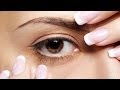 Глаукома. Лечение и профилактика. Школа здоровья 01/03/2014 GuberniaTV