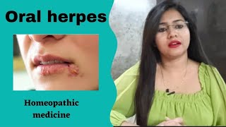 Oral herpes Homeopathic medicine!Oral herpes symptoms,causes & Homeopathic treatment! HSV infection