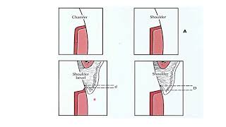 Types of finishing lines