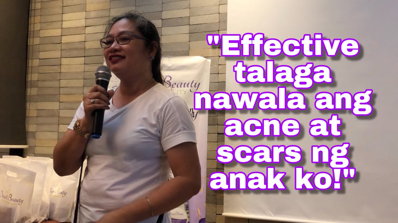 Solusyon sa Acne at Scars! How to treat acne & scars