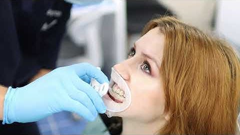 Modjaw 3D Jaw Motion - Naenae Dental Clinic NZ