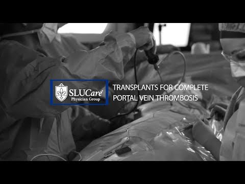 Liver Transplant for Complete Portal Vein Thrombosis - SLUCare Transplant Surgery