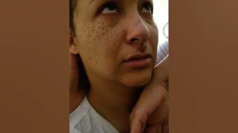Amber Burt: Smokey air seizures, asthma & asphyxia
