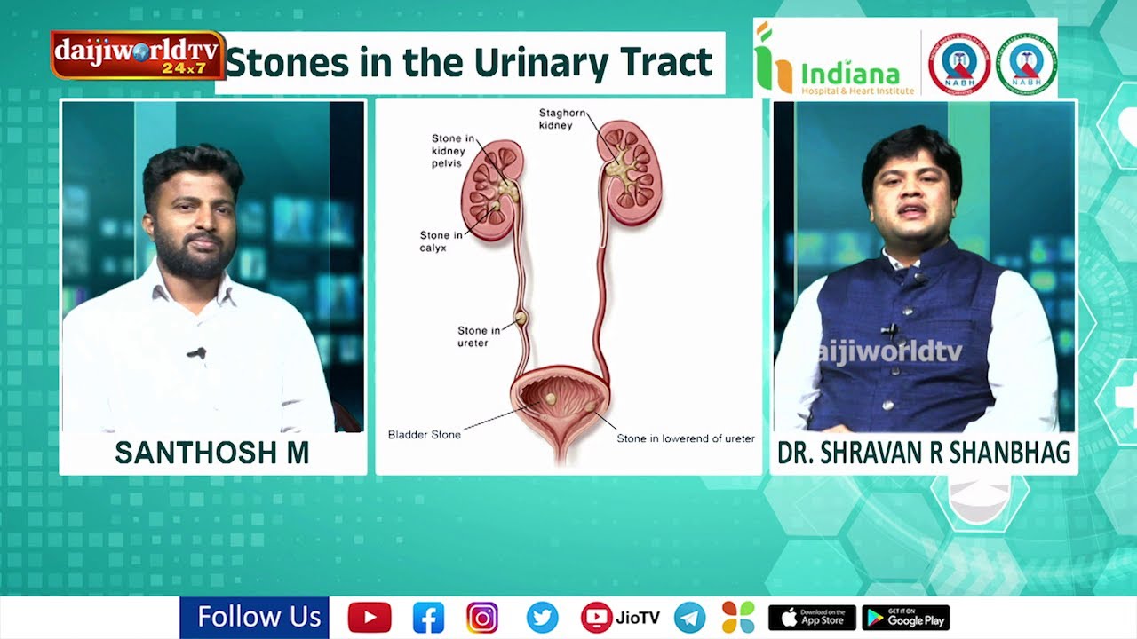 Sarvan R Health Talk : Stones in the Urinary Tract - Dr Shravan R Shanbhag ...