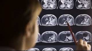 تأثير الأفلام الإباحية " الجنسية " على الدماغ :: د.عدنان ابراهيم ...