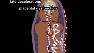 Fetal Heart Rate Monitoring Review (FHR) by Dr. Cal Shipley, M.D.