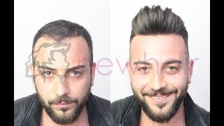 Canli Saça En Yakin Sonuçlara Şahi̇t Olun