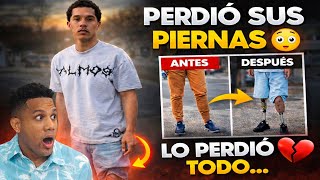 Sin sus Dos Piernas Llego a Estados Unidos por el Sueño Americano 