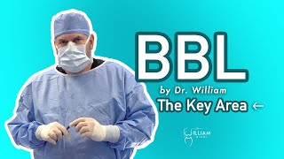 BBL by Dr William - Lipo of The Key Area