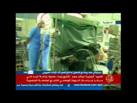 متابعة لعملية زراعة كبد في مركز جراحات جامعة المنصورة