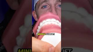 How Should Your Bite Look? Profile