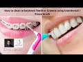 How to clean in between Teeth or Crowns using Interdental / Proxa brush