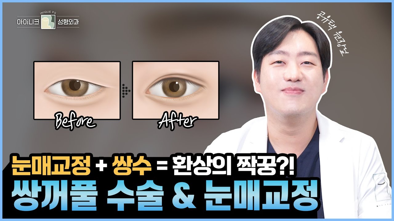 “왜 쌍수와 눈매교정을 같이할까?” 쌍꺼풀 수술과 눈매교정을 함께하는 이유는?│공유택 원장님이 알려주는 쌍꺼풀 수술과 눈매교정 이야기