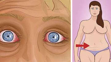 Como funciona a obesidade?