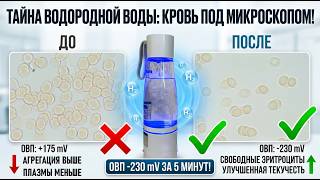 Как изменилась кровь после употребления водородной воды.