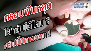 ครอบฟันหลุด ใส่กลับได้ไหม ทำไมถึงหลุด คลิปนี้มีคำตอบ ? | คลายปัญหารากฟันเทียมกับหมอโชค