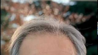 Despreocupado Principal - Pelado