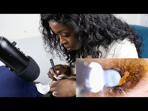 Very SUPER UPCLOSE ear picking stuff | ASMR